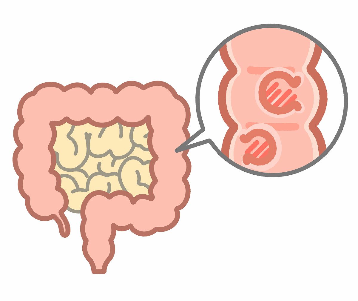 大腸がん・大腸ポリープ